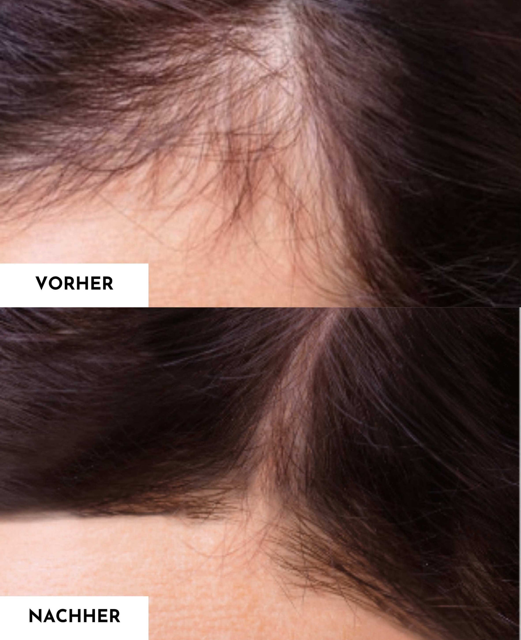 Hair Growth Booster Luxe Set